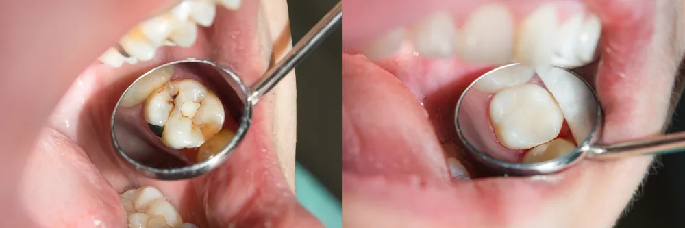 Restorative Dentistry