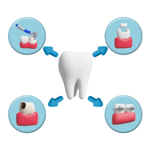 Full-mouth rehabilitation treatment plan