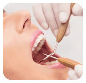 Cheers to Veneers!